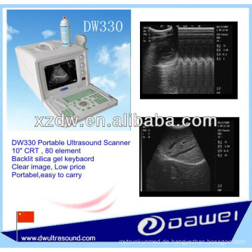 2d tragbarer volldigitaler Ultraschallscanner